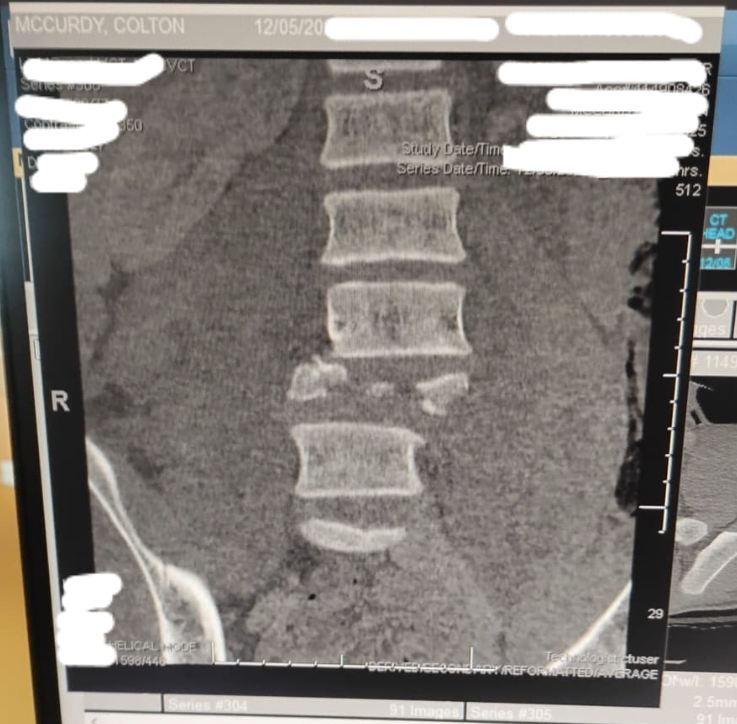 Medical Bills for Colton McCurdy