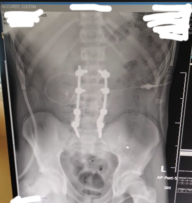 Medical Bills for Colton McCurdy